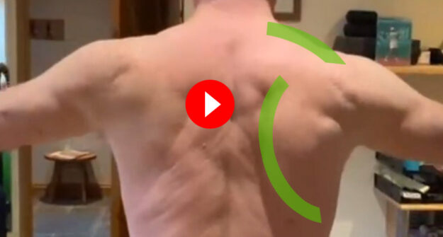 Anterior Shoulder Pain: Why the Shoulder Blade Matters More Than You Think